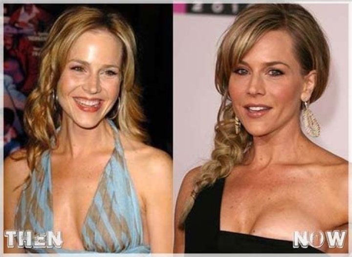 Emily Procter Breast Implants Plastic Surgery Before and After