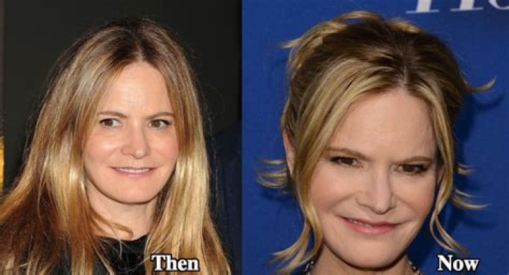 Jennifer Jason Leigh Plastic Surgery: An Unnatural Appearance Catching Fan's Attention!