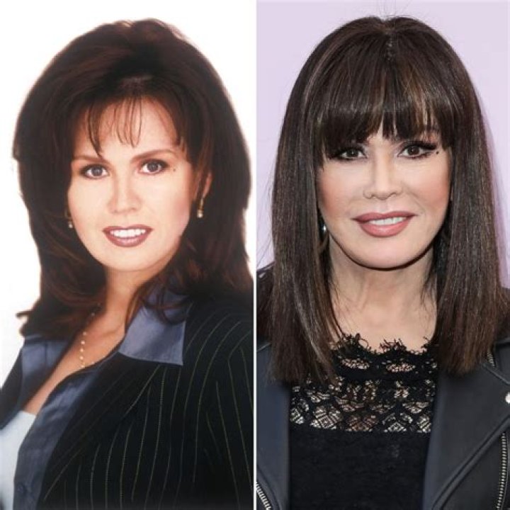 Marie Osmond Plastic Surgery: Adopting Artificial Enhancers or Glowing Naturally!